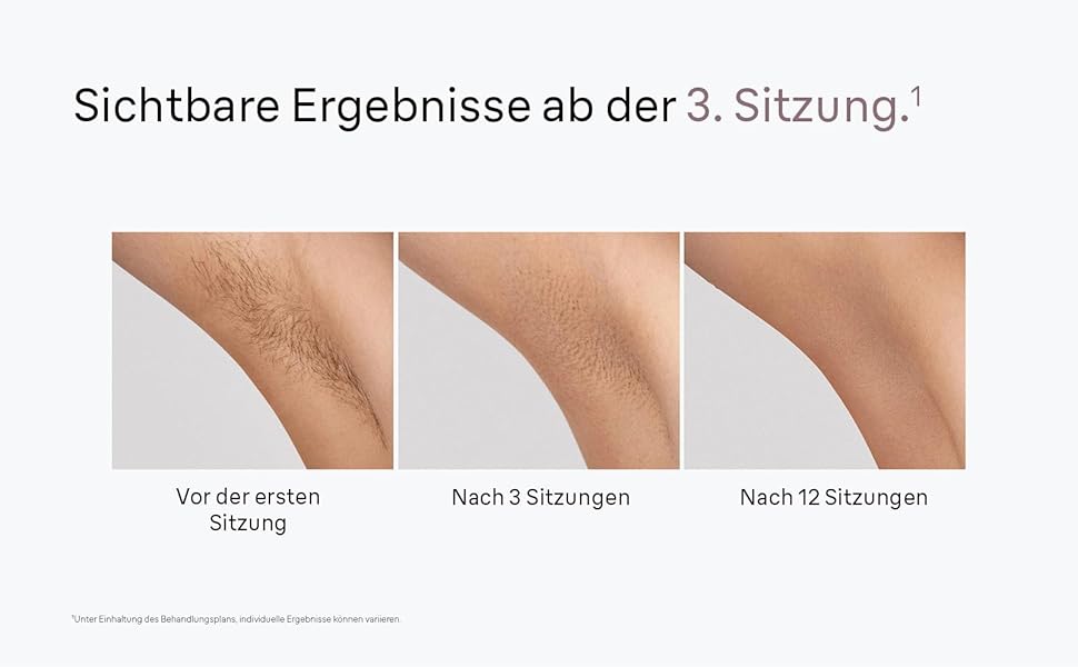 Фотоепілятор Braun Silk-expert Mini PL1112 для домашньої тривалої епіляції, рожевий (з міні-бритвою, бритвою Gillette Venus та аксесуарами)